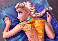 Elsa Back Treatment