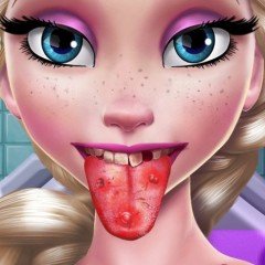 Elsa Tongue Doctor