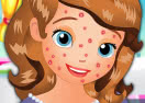 Sofia Squeeze Pimples